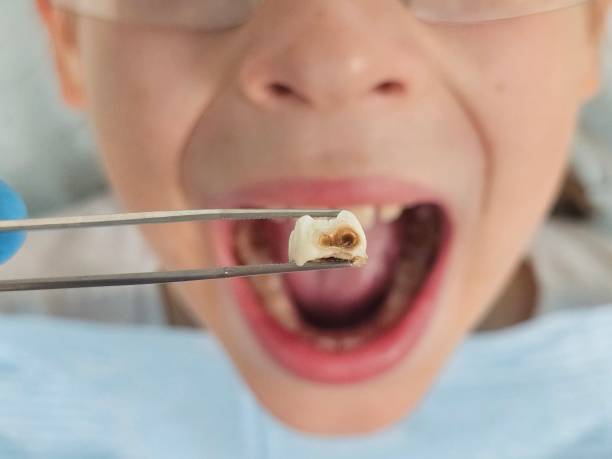 Best Orthodontic Emergency Dentist in Oxford, MI
